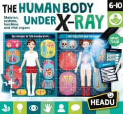 Headu Lidské tělo pod rentgenem