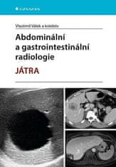 Vlastimil Válek; kolektiv: Abdominální a gastrointestinální radiologie - JÁTRA