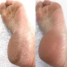 LOVA│SKIN Instant Foot Peeling Sada