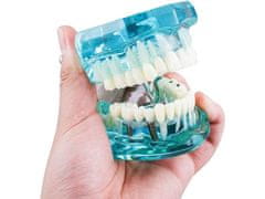 Verk 01964_N Model zubních implantátů modrá