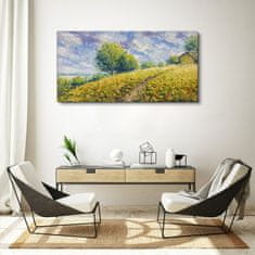 COLORAY.CZ Obraz na plátně Hill louka stromy obloha 120x60 cm