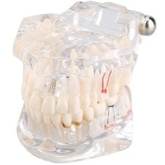 Verk 01964_B Model zubních implantátů bílá