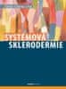 Tomáš Soukup: Systémová sklerodermie