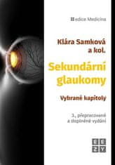 Klára Samková: Sekundární glaukomy