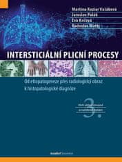 Vašáková Martina Koziar: Intersticiální plicní procesy