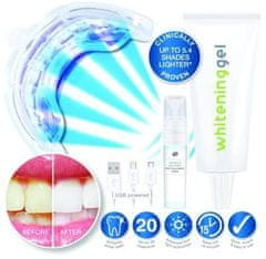 RIO Usb teeth whitening