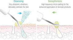 RIO Ultrasonic facial usb