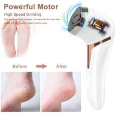 VivoVita Foot Grinder – Pilník na paty