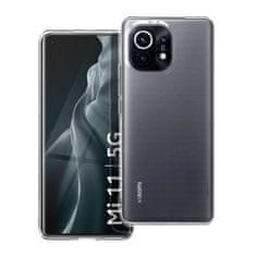 OEM Pouzdro OEM CLEAR Case 2 mm pro XIAOMI Mi 11 (camera protection) transparent