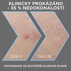 Sérum proti nedokonalostem pleti AHA + BHA Charcoal (Serum) 30 ml