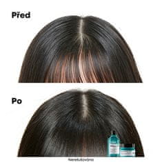 Loreal Professionnel Čisticí šampon pro mastnou pokožku hlavy Scalp Advanced (Anti Oiliness Dermo Purifier Shampoo) (Objem 300 ml)