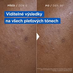 Mixa Hydratační krém proti tmavým skvrnám Niacinamide Bright (Moisturizing Anti-Dark Spot Cream) 400 ml