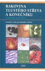 Rostislav Vyzula: Rakovina tlustého střeva a konečníku