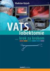 Vladislav Hytych: VATS lobektomie - ...krok za krokem