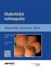 Tomáš Sosna: Diabetická retinopatie - Diagnostika, prevence, léčba