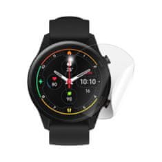 SCREENSHIELD XIAOMI Mi Watch - Fólie na displej