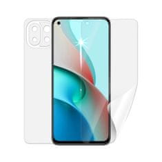 SCREENSHIELD XIAOMI Mi 11 Lite 5G - Fólie na celé tělo