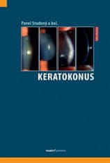 Pavel Studený: Keratokonus