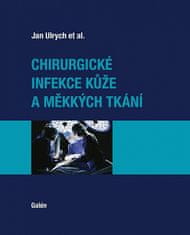 Jan Ulrych: Chirurgické infekcekůže a měkkých tkání