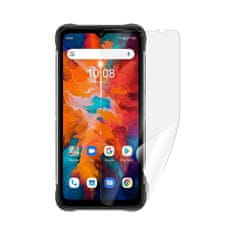 SCREENSHIELD UMIDIGI Bison X10 - Fólie na displej