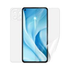 SCREENSHIELD XIAOMI 11 Lite 5G NE - Fólie na celé tělo