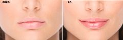 FacEvolution Lesk na rty lipPLUS BOOSTER