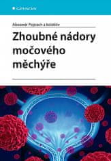 Alexandr Poprach: Zhoubné nádory močového měchýře