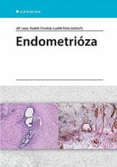 Lenz Jiří: Endometrióza