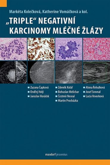 Markéta Kolečková: „Triple“ negativní karcinomy mléčné žlázy