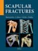 Jan Bartoníček: Scapular fractures