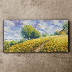 COLORAY.CZ Obraz na plátně Hill louka stromy obloha 120x60 cm