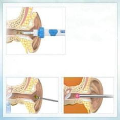 FRILLA® Elektrický čistič ušního mazu, Přístroj na čišění uší, Vakuový odstraňovač ušního mazu | EARSIO