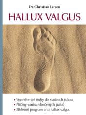 Christian Larsen: Hallux valgus