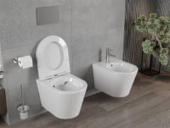 Mexen Rico závěsná wc mísa rimless včetně sedátka s slow-slim, duroplast, bílá (30720300)